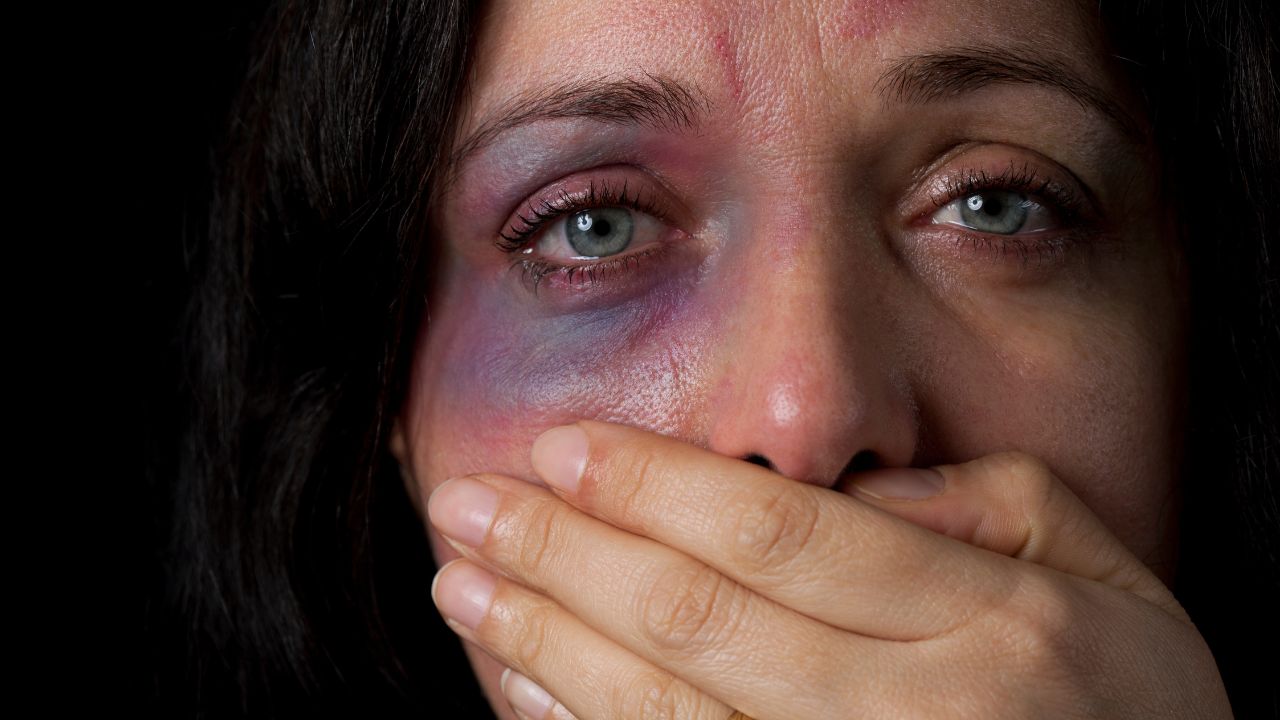 Nahaufnahme des Gesichts einer Frau mit Verletzungen und Blutergüssen im Gesicht, die sich mit der Hand den Mund bedeckt – Symbolbild für häusliche Gewalt gegen Frauen.
