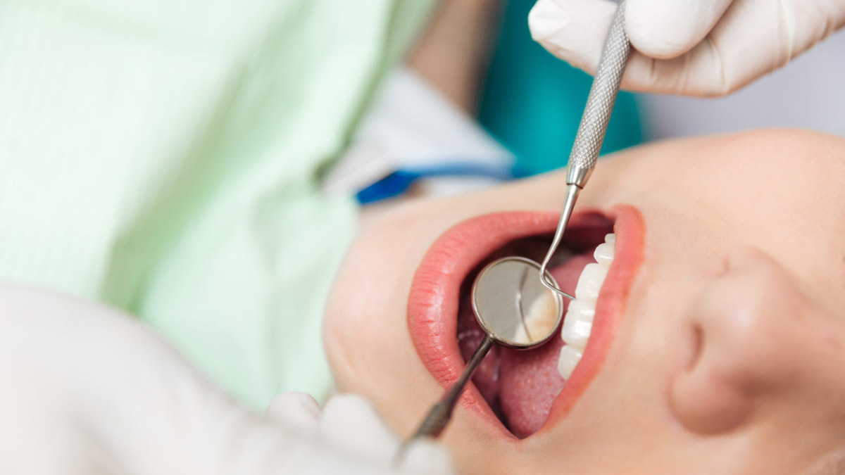 Zahnuntersuchung bei geöffnetem Mund